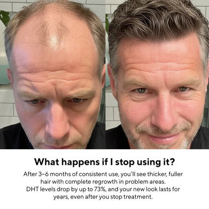 Glow Peptide Infusion – Microneedling Hair Growth Therapy with GHK-Cu & Multi-Peptide Complex