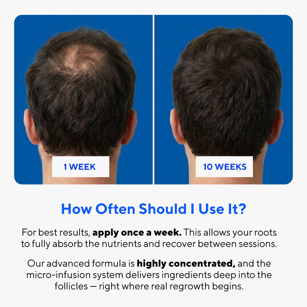 Glow Peptide Infusion – Microneedling Hair Growth Therapy with GHK-Cu & Multi-Peptide Complex