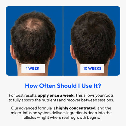 Glow Peptide Infusion – Microneedling Hair Growth Therapy with GHK-Cu & Multi-Peptide Complex