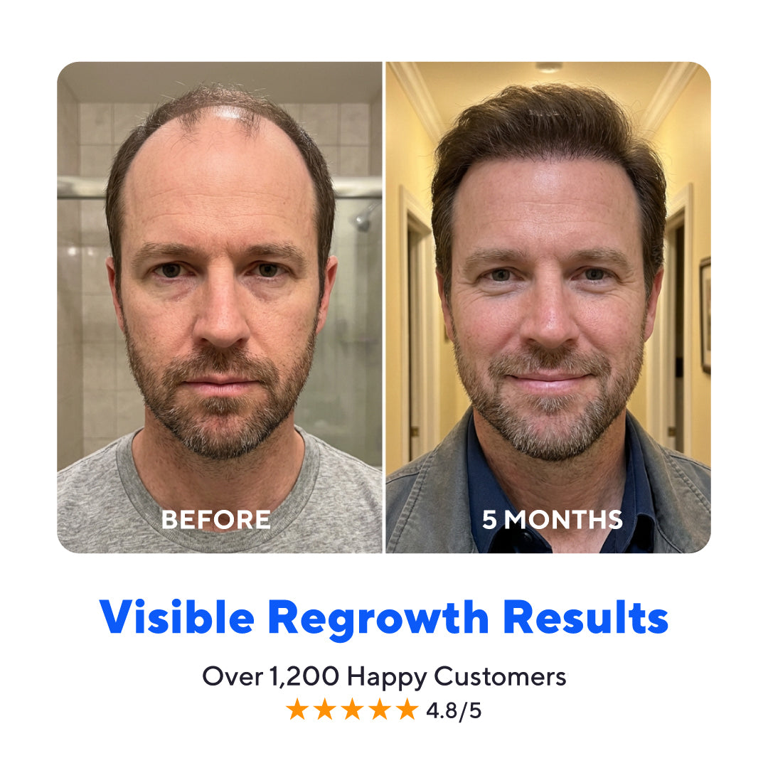 Glow Peptide Infusion – Microneedling Hair Growth Therapy with GHK-Cu & Multi-Peptide Complex