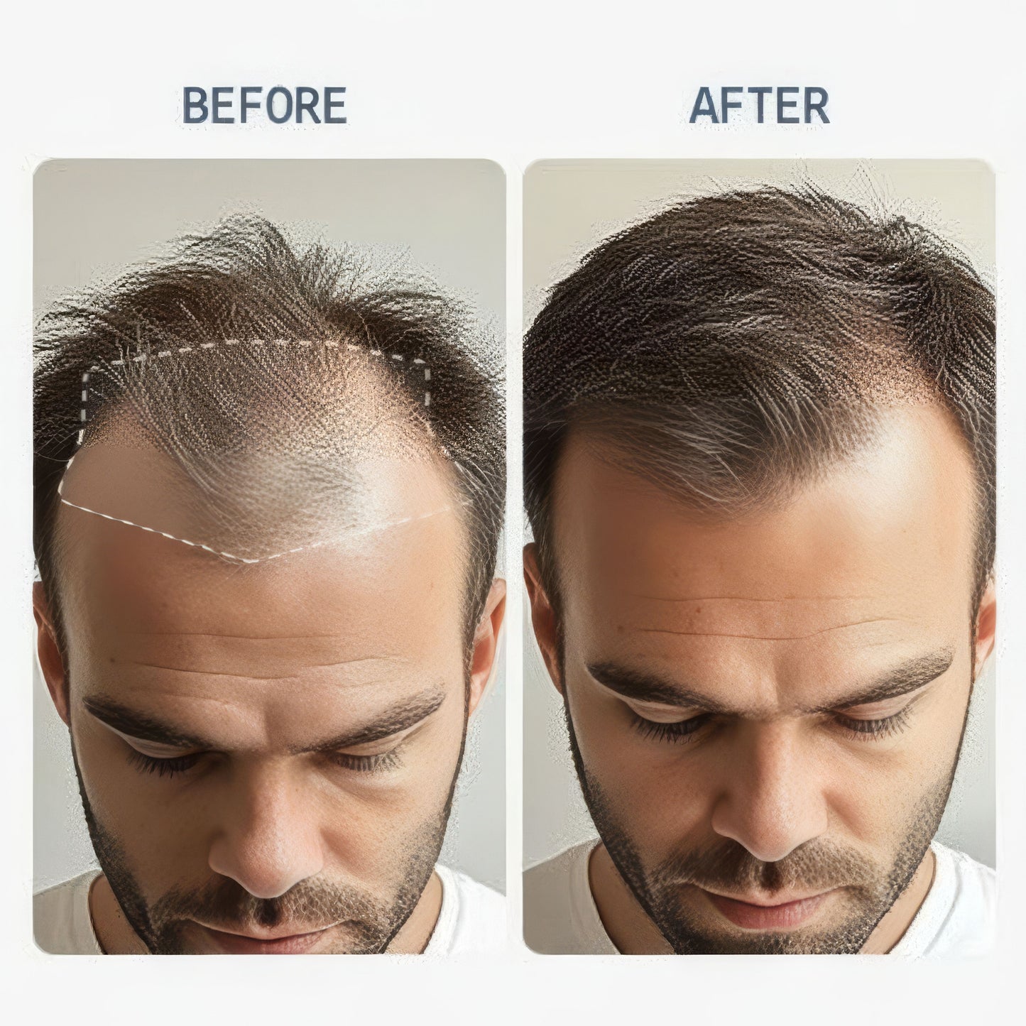 Advanced Hair Growth Roll-On Serum
