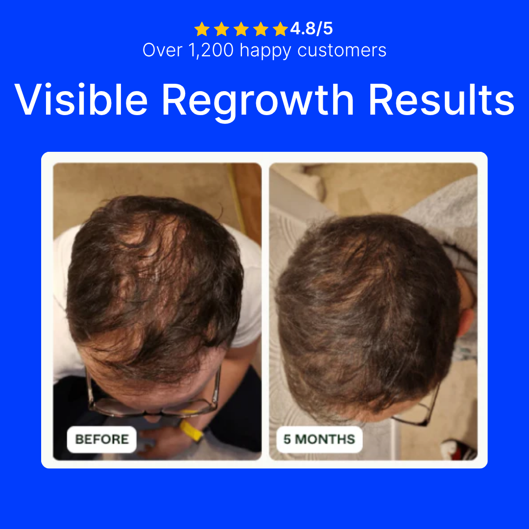 Glow Peptide Infusion – Microneedling Hair Growth Therapy with GHK-Cu & Multi-Peptide Complex