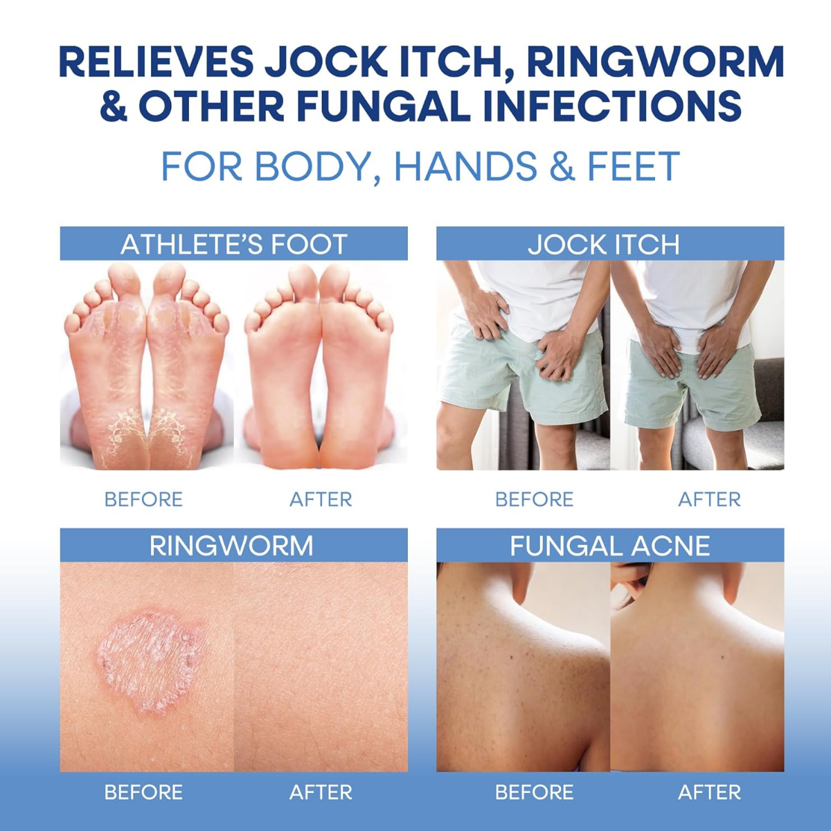 Antifungal Relief Soap Bar