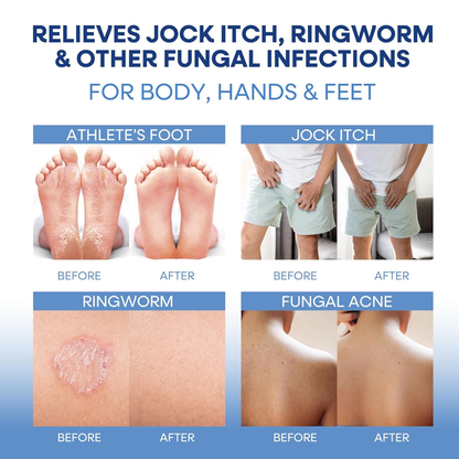 Antifungal Relief Soap Bar