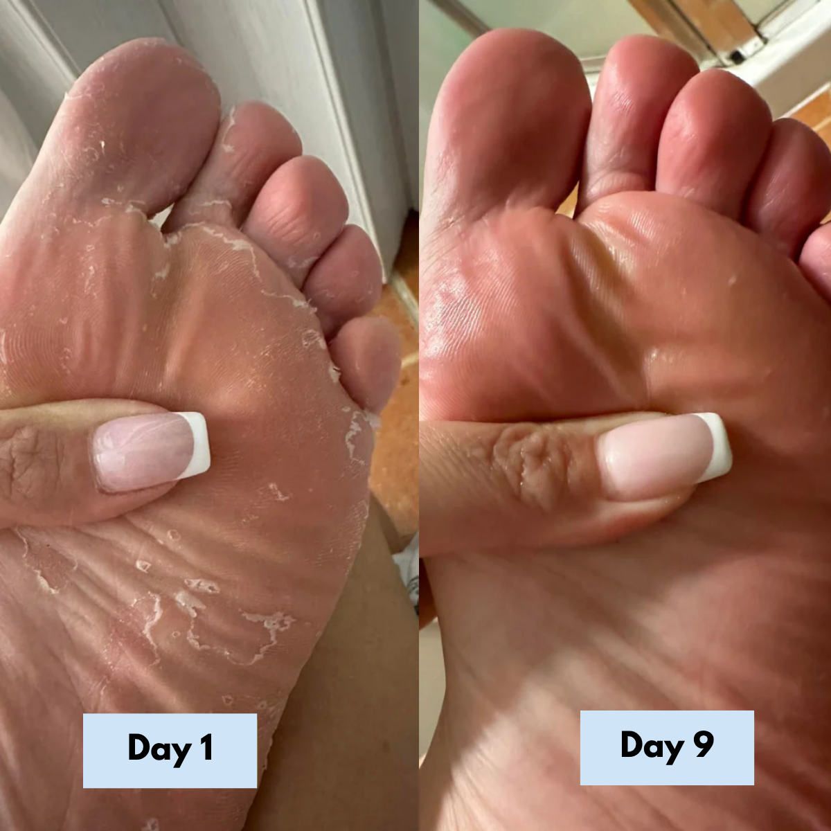 Antifungal Relief Soap Bar